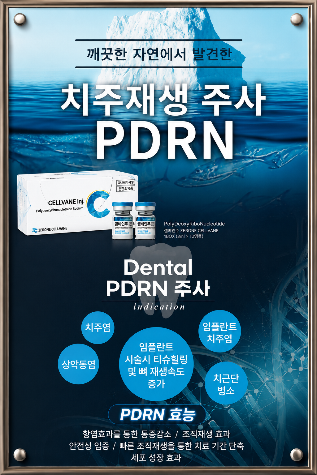 특화된 치주 재생치료 (PDRN)